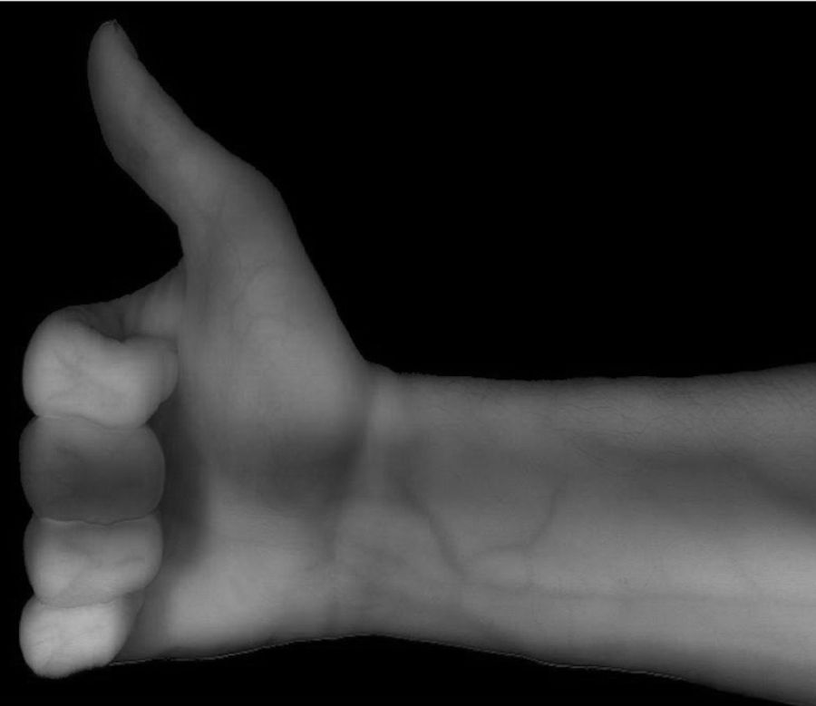 Scan of Arm