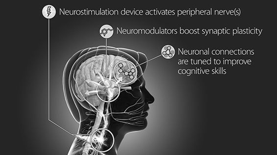 Elective mind control